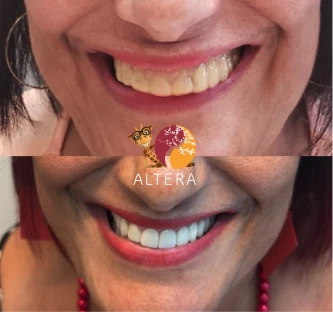 resul_altera09_1x